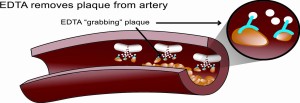 EDTA Pix